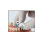 Kit Benzi StripFix Edenta - imagine 4